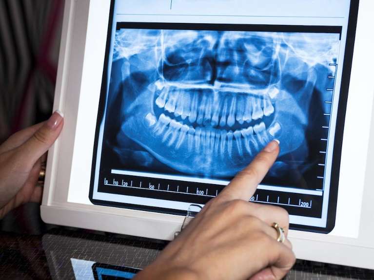 Digital X-Ray machine at Karis Family Dental Whittier