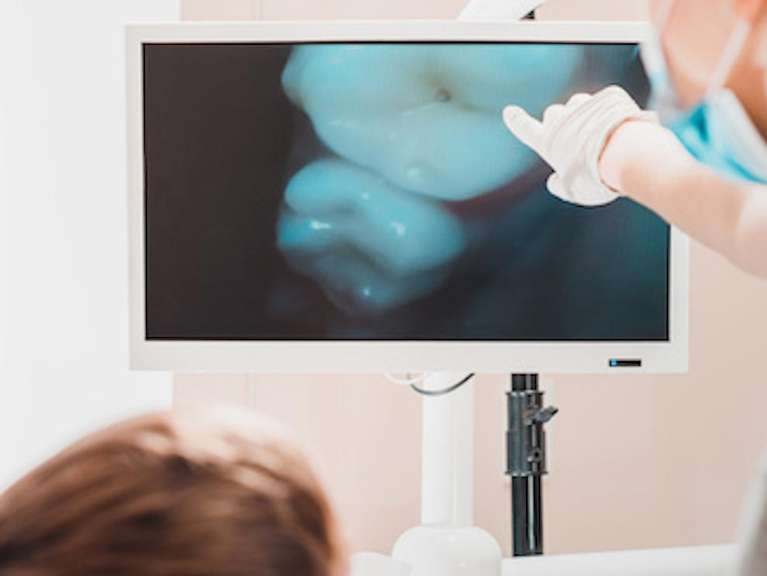 Intraoral camera used at Karis Family Dental
